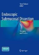 Endoscopic Submucosal Dissection