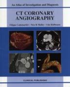 CT Coronary Angiography: Atlas of Investigation and Management