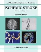 Ischemic Stroke