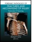 Forensic Pathology of Fractures and Mechanisms of Injury