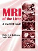 MRI of the Liver