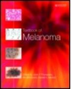 Textbook of Melanoma