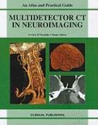 Multidetector CT in Neuroimaging