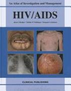 HIV/AIDS