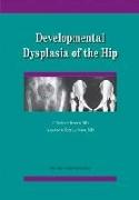 Developmental Dysplasia of the Hip