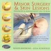 Minor Surgery And Skin Lesions