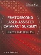 Femtosecond Laser-assisted Cataract Surgery