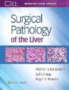 SURGICAL PATHOLOGY OF THE LIVER
