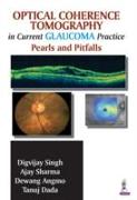 Optical Coherence Tomography in Current Glaucoma Practice