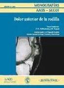 Dolor anterior de rodilla