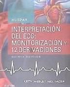 Interpretación del ECG : monitorización y 12 derivaciones
