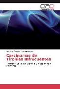 Carcinomas de Tiroides Infrecuentes