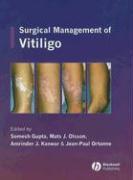 Surgical Management of Vitiligo