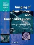 Imaging of Bone Tumors and Tumor-Like Lesions
