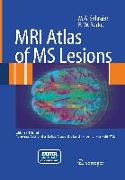 MRI Atlas of MS Lesions