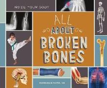 All about Broken Bones