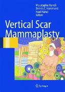 Vertical Scar Mammaplasty