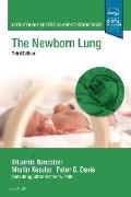 The Newborn Lung: Neonatology Questions and Controversies