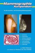 Mammographie-Kompendium für die kurative- und Screening-Mammographie