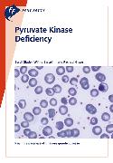 Fast Facts: Pyruvate Kinase Deficiency