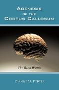 Agenesis of the Corpus Callosum
