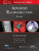 Advanced Reconstruction: Knee: Print + Ebook with Multimedia