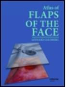 Atlas of Flaps of the Face