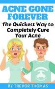 Acne Gone Forever: The Quickest Way to Completely Cure Your Acne