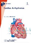 Fast Facts: Cardiac Arrhythmias