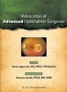 Video Atlas of Advanced Ophthalmic Surgeries