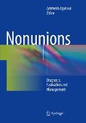 Nonunions