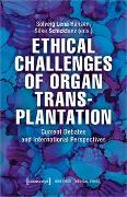 Ethical Challenges of Organ Transplantation