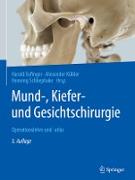 Mund-, Kiefer- und Gesichtschirurgie