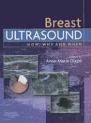 Breast Ultrasound