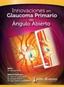 Innovaciones en Glaucoma Primario de Angulo Abierto