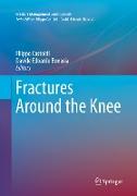 Fractures Around the Knee