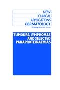 Tumours, Lymphomas and Selected Paraproteinaemias