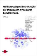 Molekular zielgerichtete Therapie der chronischen myeloischen Leukämie (CML)