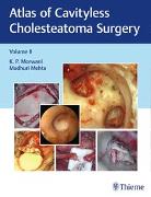 Atlas of Cavityless Cholesteatoma Surgery, Vol 2