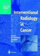 Interventional Radiology in Cancer