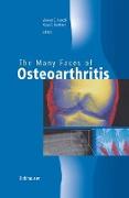 The Many Faces of Osteoarthritis