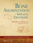 Bone Augmentation in Implant Dentistry: A Step-By-Step Guide to Predictable Alveolar Ridge and Sinus Grafting