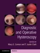 Diagnostic and Operative Hysteroscopy