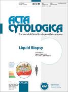 Liquid Biopsy
