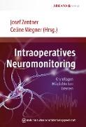 Intraoperatives Neuromonitoring