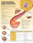 Understanding High Cholesterol Paper