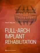 Full-Arch Implant Rehabilitation