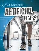 Artificial Limbs