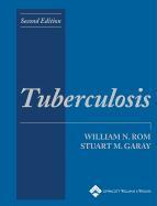 Tuberculosis