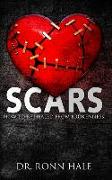 Scars: How to Be Healed from Brokenness